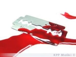 Czy podcięcie żył boli? Sprawdź, czego się spodziewać i jakie niesie ryzyko